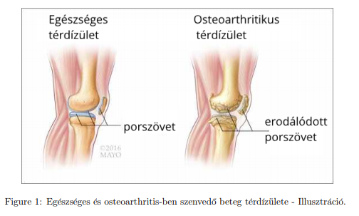 őssejt áttekintése arthrosis kezelés)